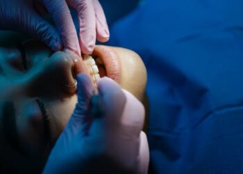 Evaluate the Orthodontic Devices Company SmileSet on Diastema