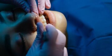 Evaluate the Orthodontic Devices Company SmileSet on Diastema